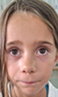 Lily FOUDIL
